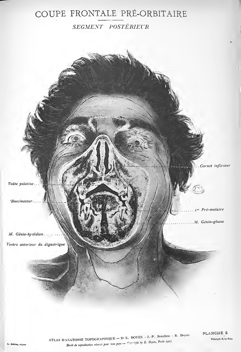 Doyen, Atlas d'anatomie topographique, 1911