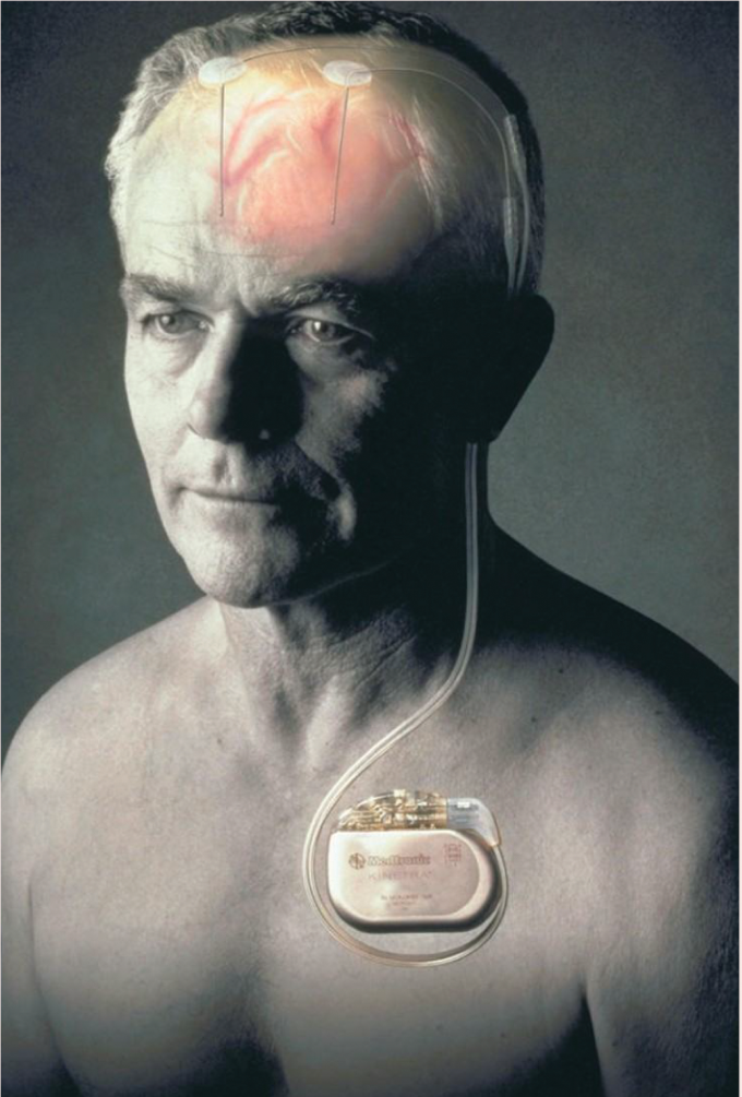 Body as living machine