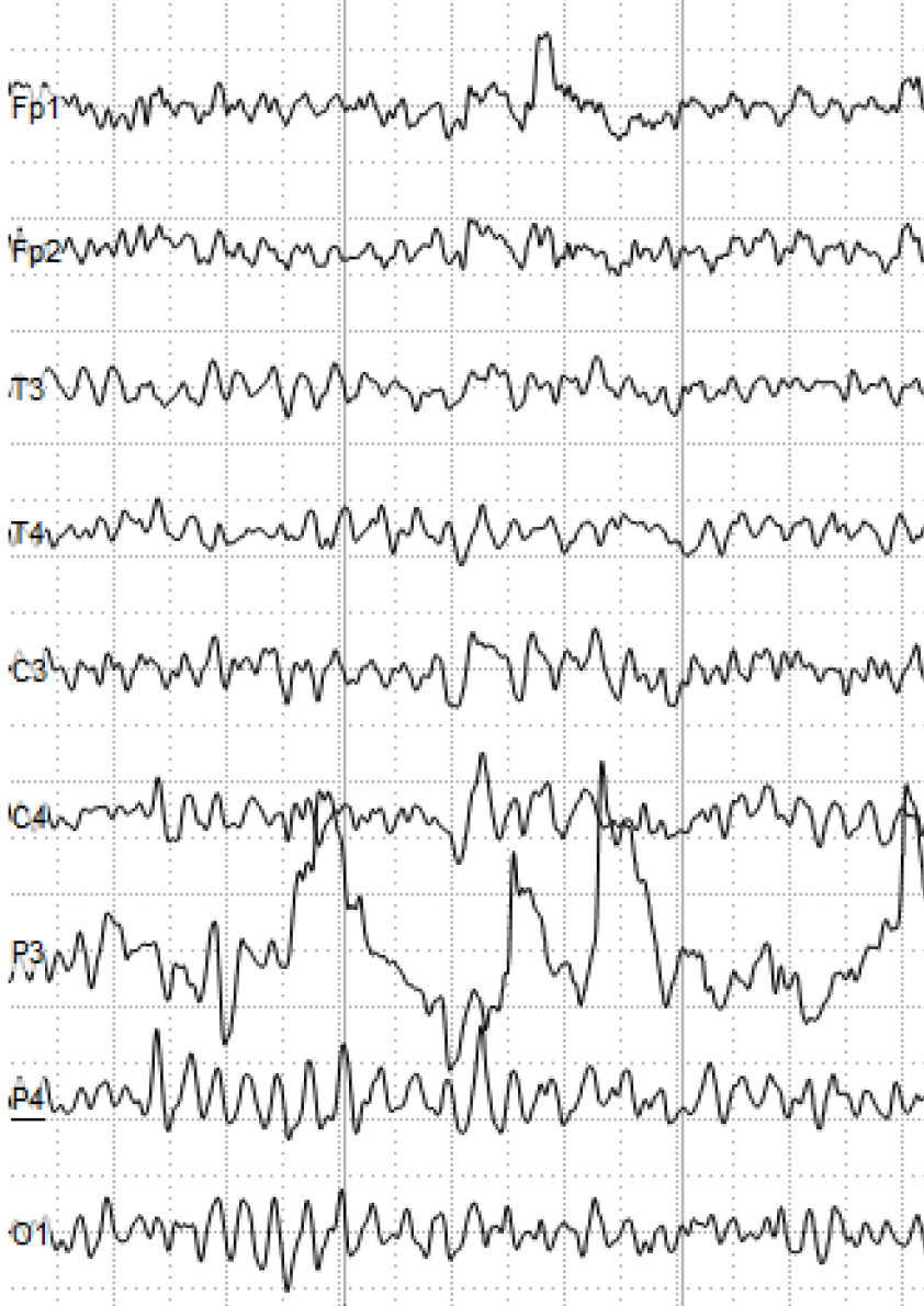 Brain Waves from an EEG