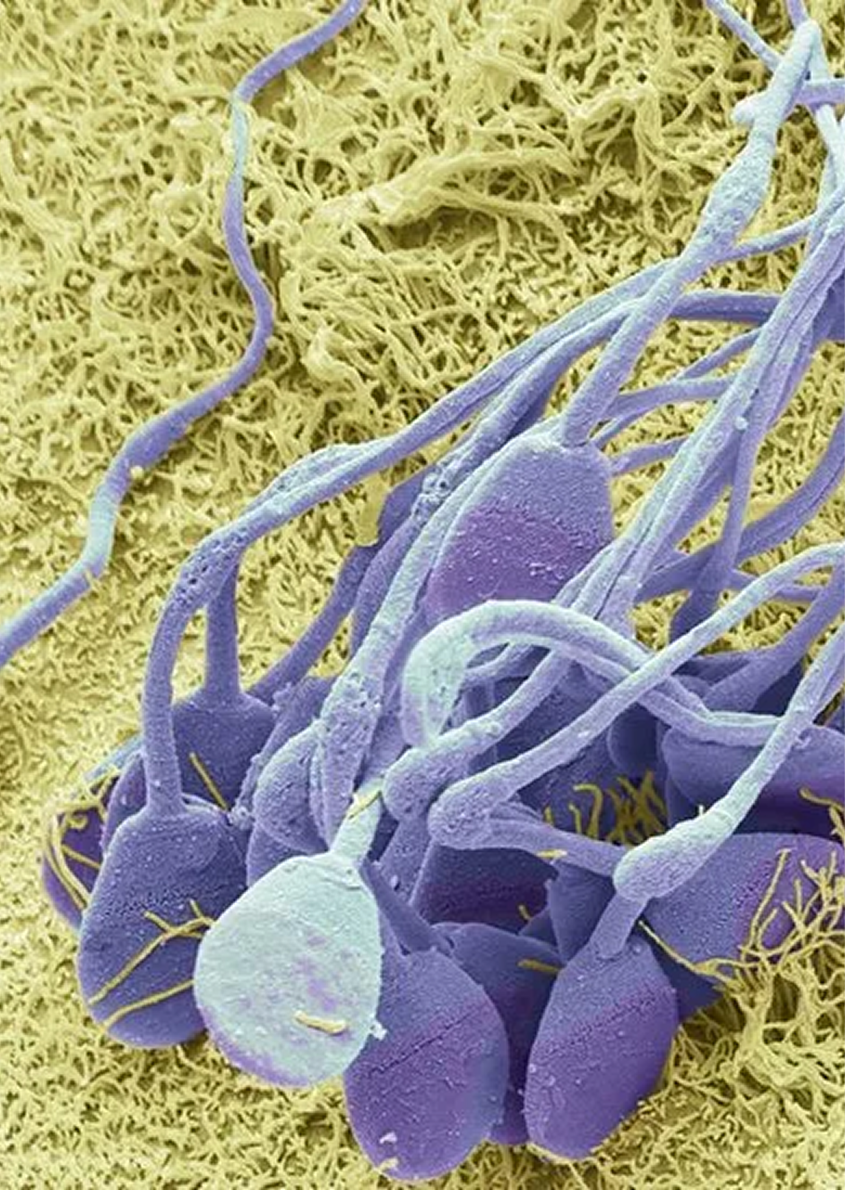 Sperm from an electron microscope