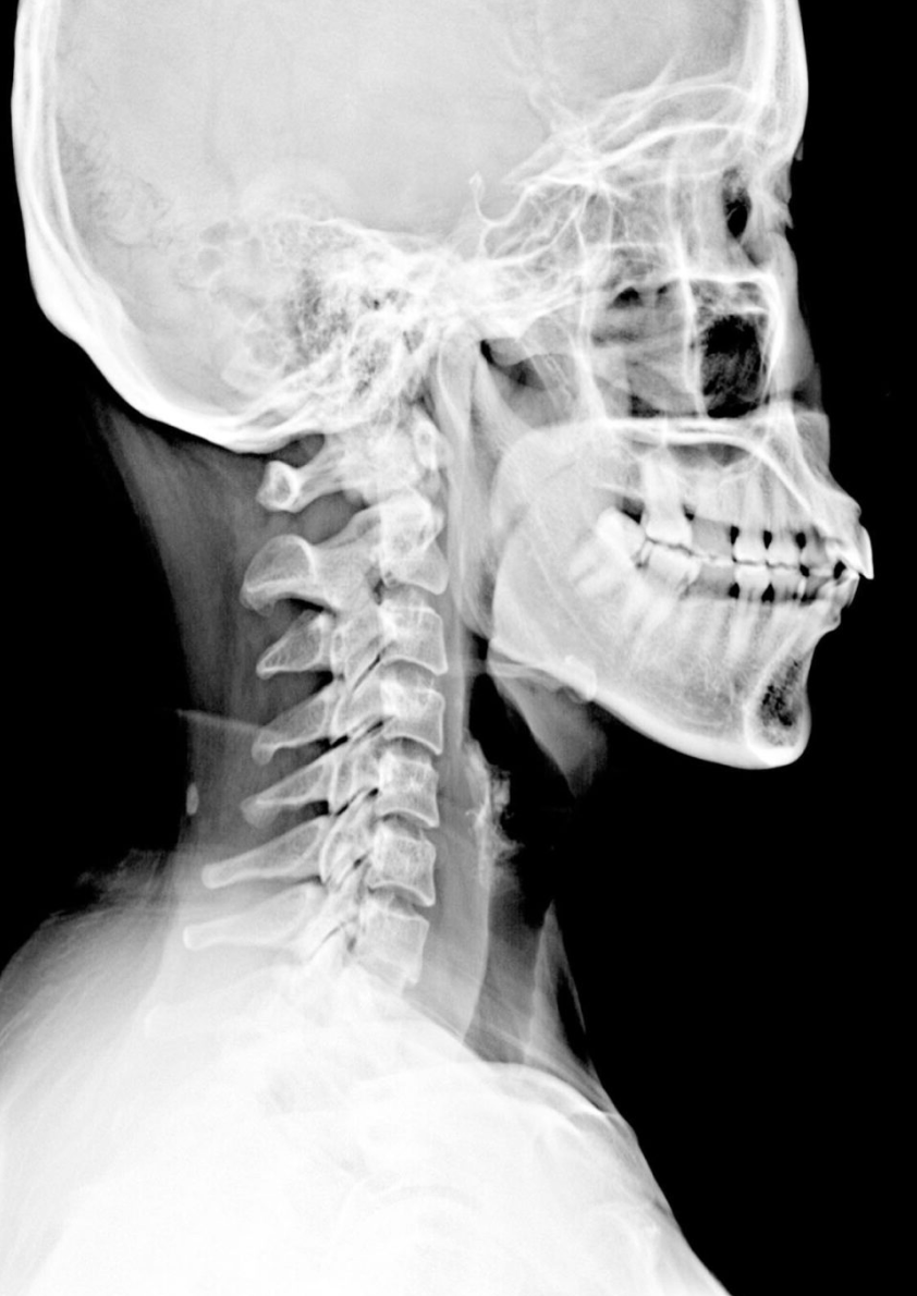 Neck and head from an X-Ray
