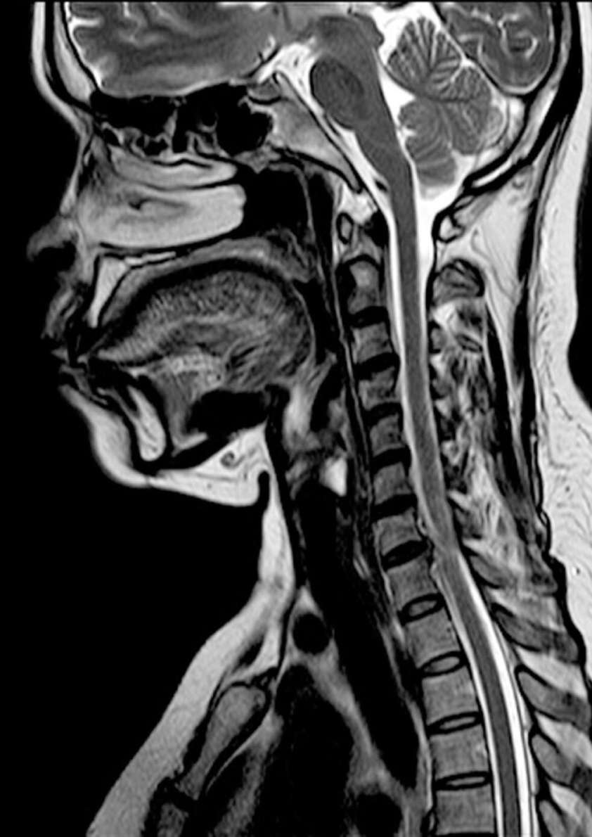 Neck and head from an MRI