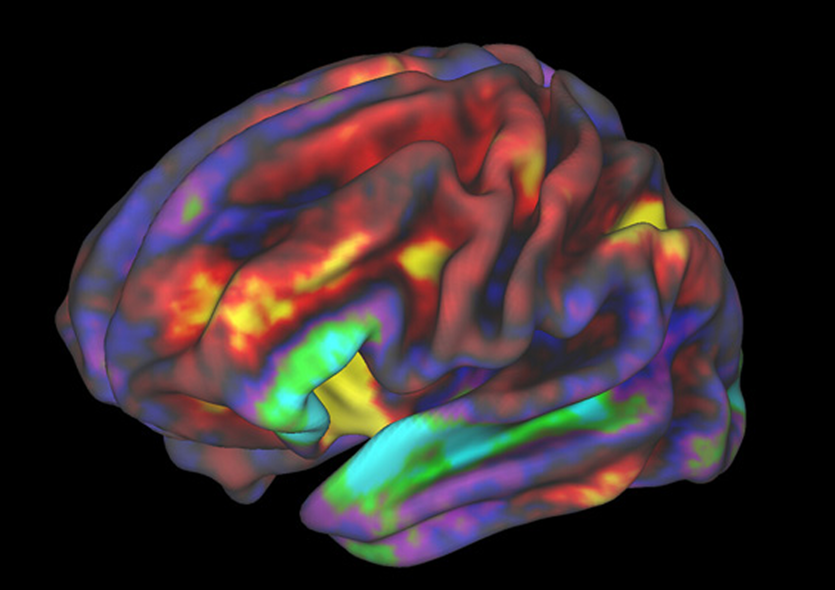 Brain from an fMRI
