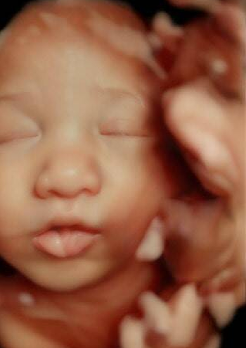 Baby in utero from Ultrasound